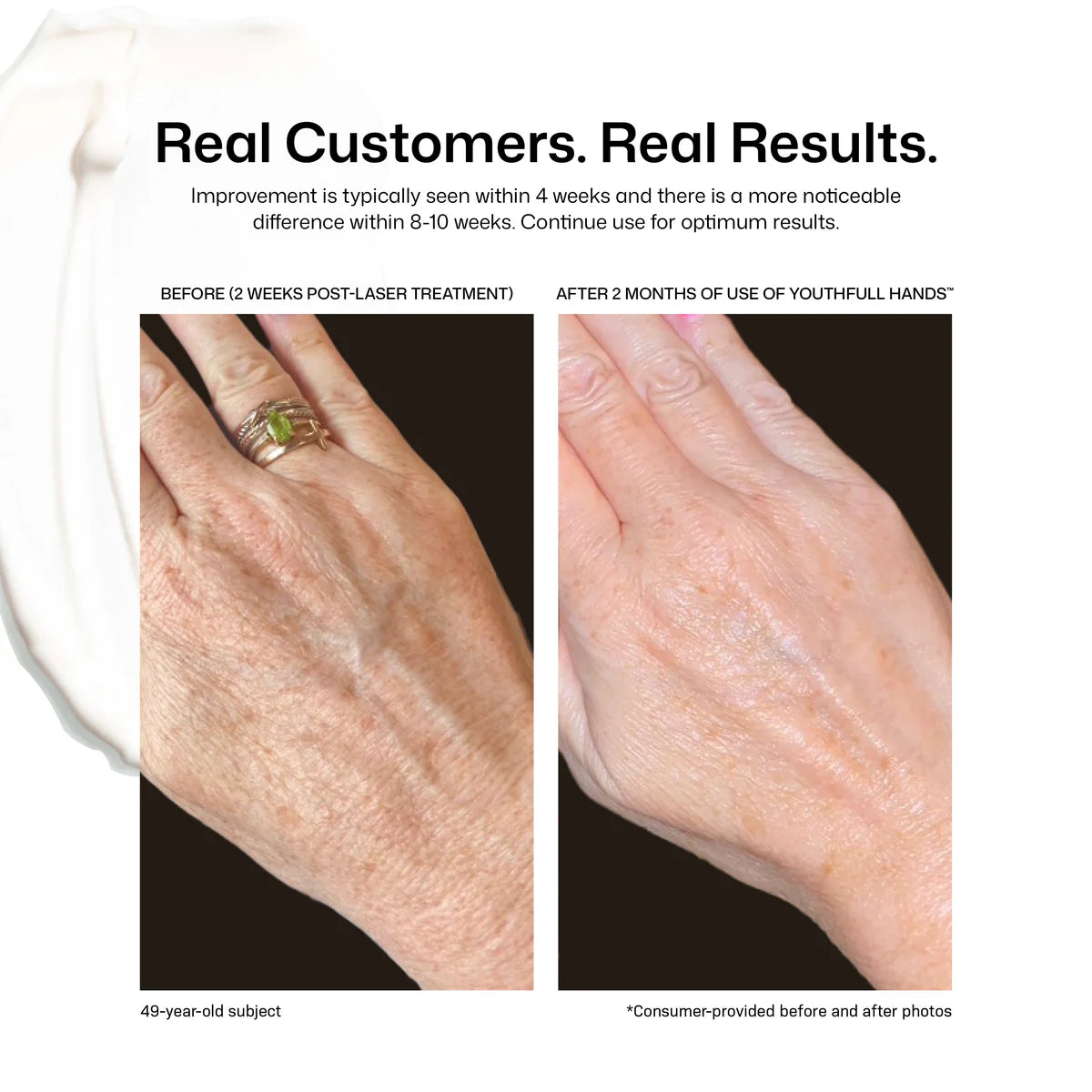 Youthful Hands