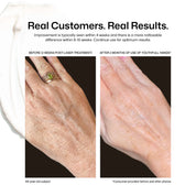 Youthful Hands